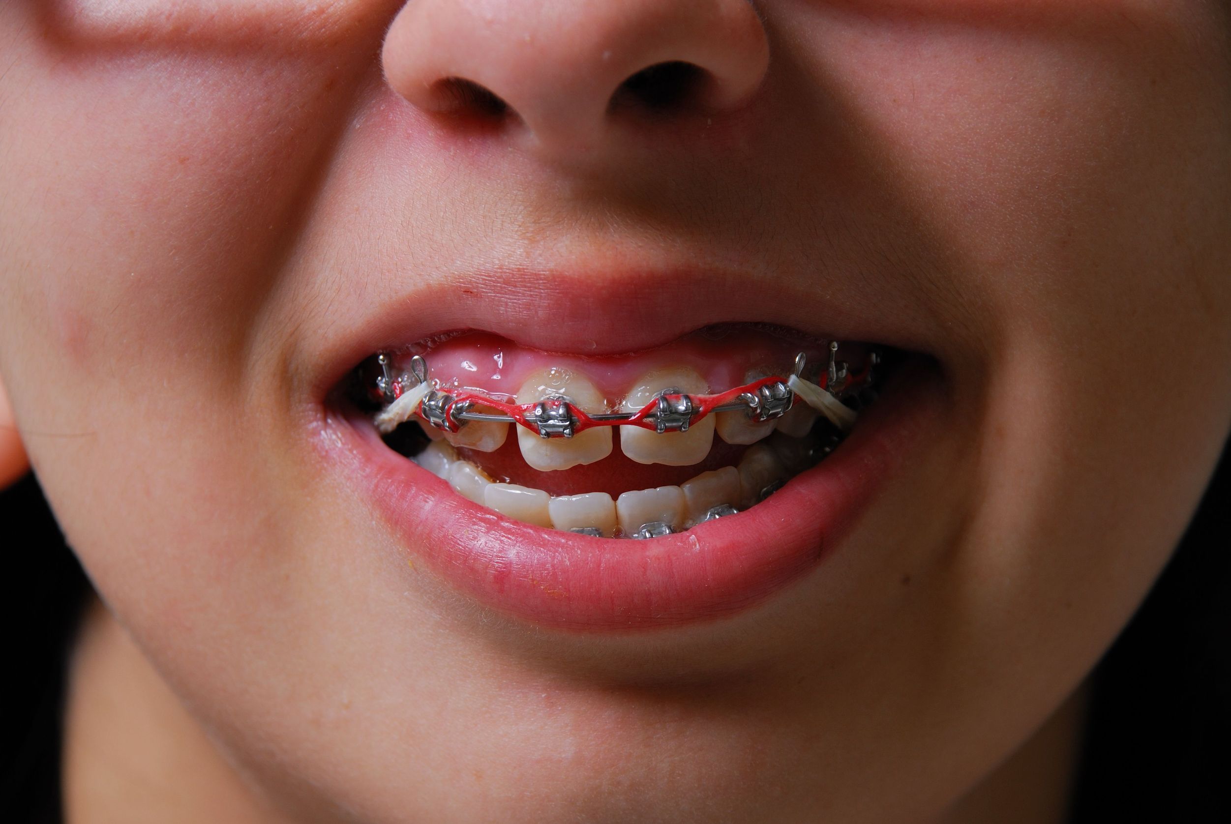The Role of an Orthodontist in Long Beach, CA